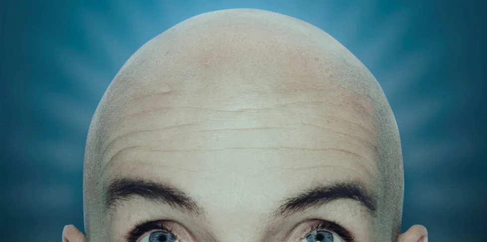 Baldies Intro. Baldies Intro.