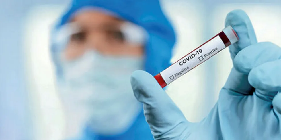Chilean salmon farmer AquaChile is ready to play a role in the fight against the novel coronavirus, known as Covid-19.
