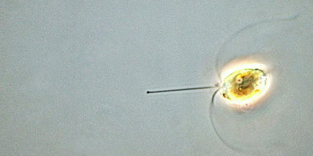 DØDELIG: Oppblomstring av planktonalgen Chrysochromulina leadbeaterii har tatt knekken på store mengder oppdrettslaks i Nordland og Sør-Troms.