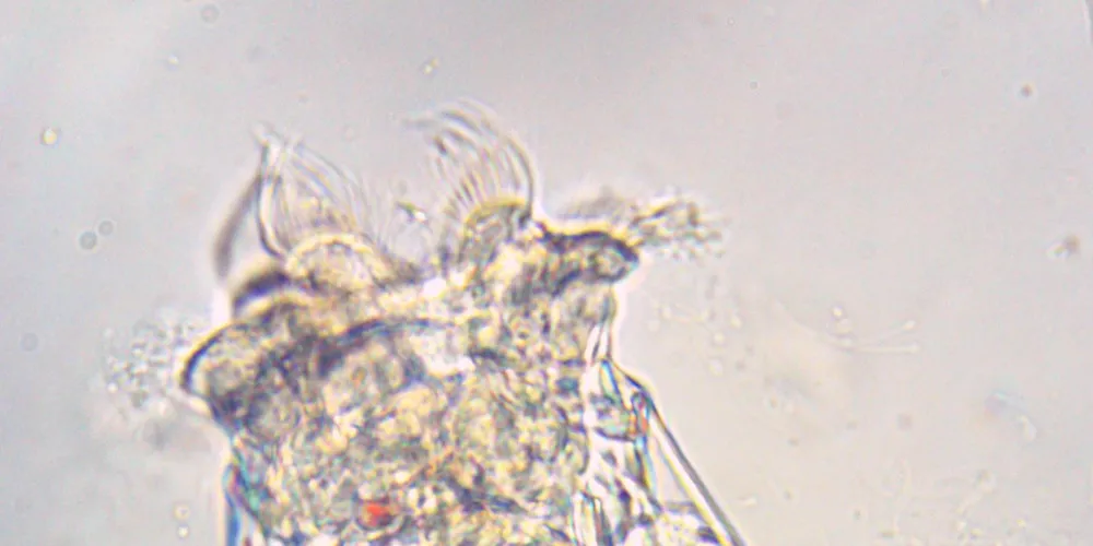 Brachionus plicatilis rotifer feasting on Reed Mariculture’s RotiGrow® OneStep.